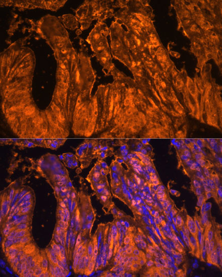 LGALS4 Polyclonal Antibody