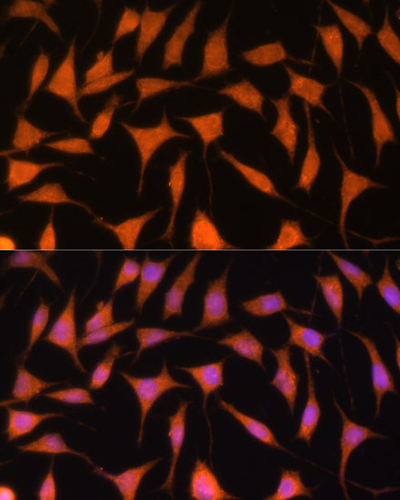 TIMM44 Polyclonal Antibody