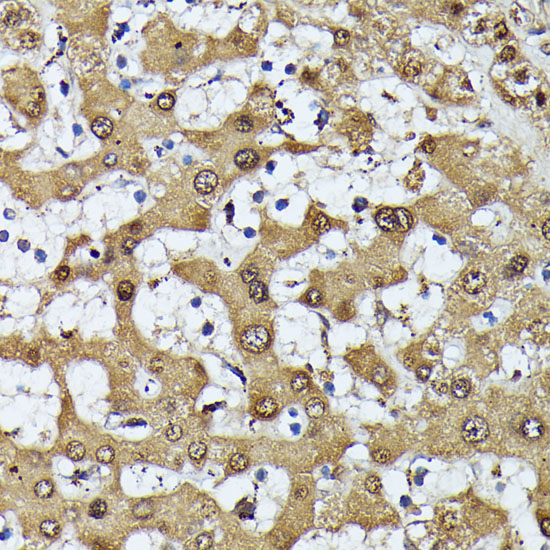 MAK Polyclonal Antibody
