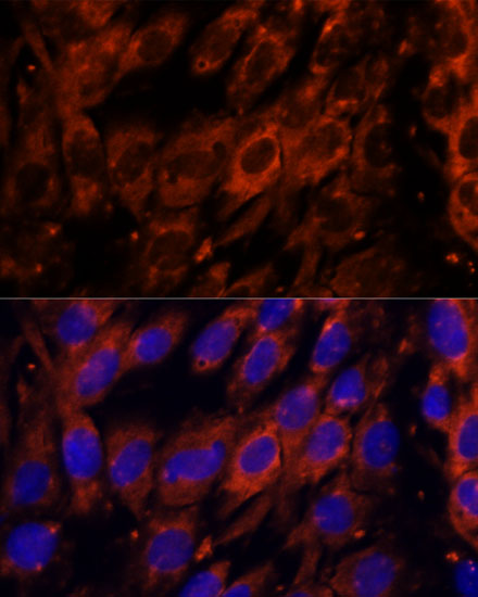 PDE6G Polyclonal Antibody