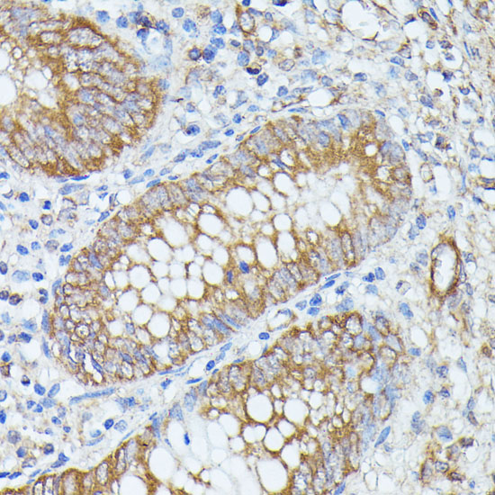 PNLIPRP1 Polyclonal Antibody