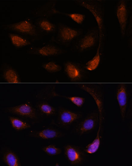 SH3BGRL Polyclonal Antibody