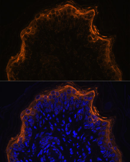 SPRR1A Polyclonal Antibody