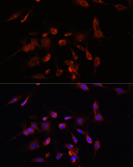 TMEM11 Polyclonal Antibody