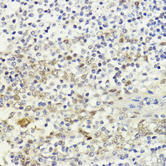 LDB1 Polyclonal Antibody