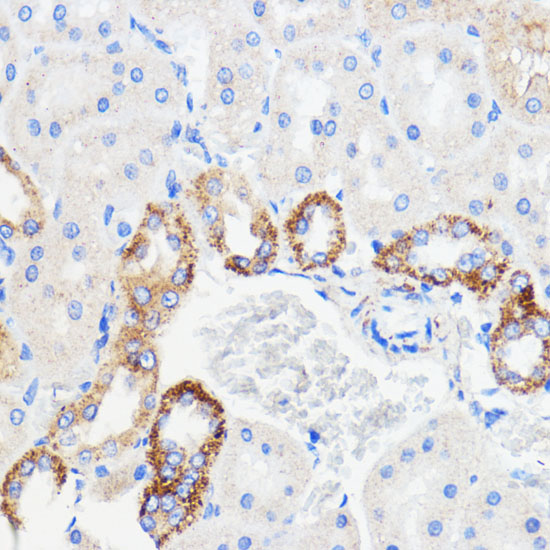 TMED3 Rabbit Polyclonal Antibody
