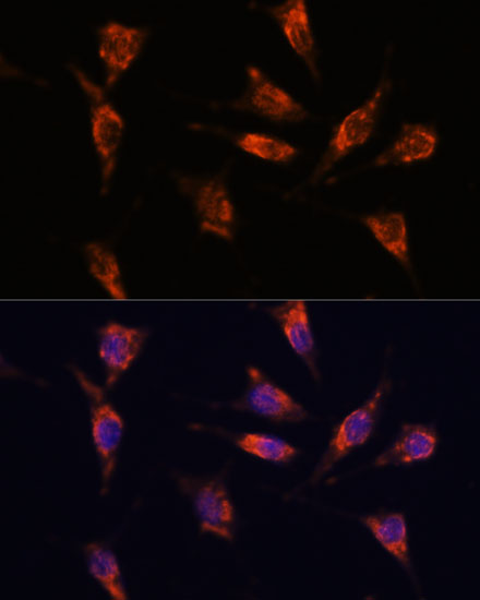 GNPNAT1 Polyclonal Antibody