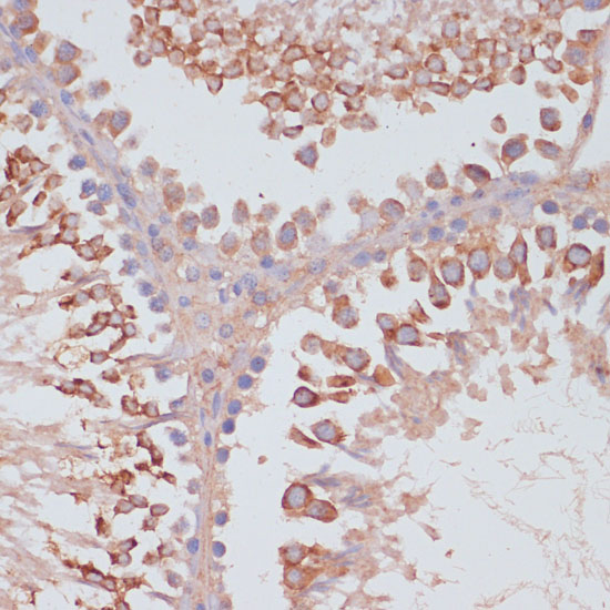 MRPL41 Rabbit Polyclonal Antibody
