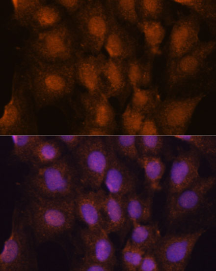 PRKRIP1 Polyclonal Antibody