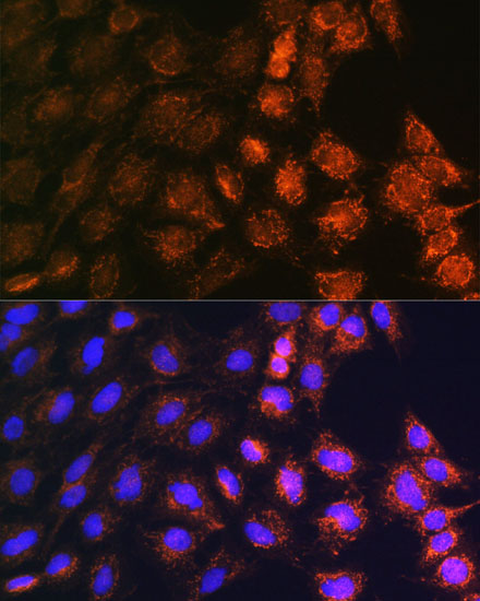 SLC25A22 Polyclonal Antibody
