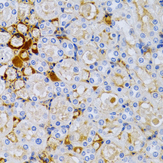 TFF1 antibody