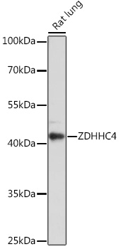 ZDHHC4 Polyclonal Antibody