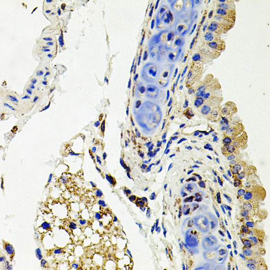 SDC2 antibody