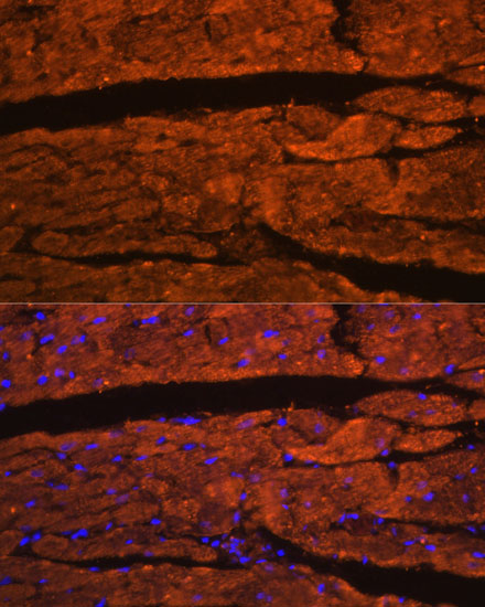 OBSCN Polyclonal Antibody