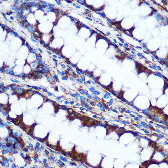 HILPDA Polyclonal Antibody