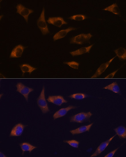FSTL4 Polyclonal Antibody