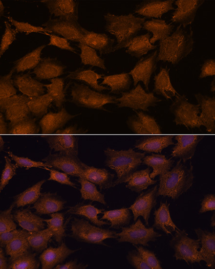 NCAPD2 Rabbit Polyclonal Antibody