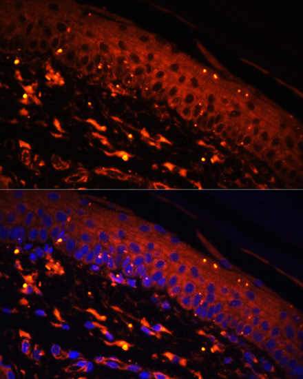 FSCN1 Polyclonal Antibody