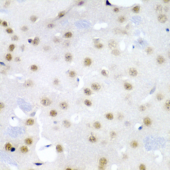 CDC27 Rabbit Polyclonal Antibody