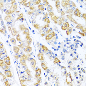 CDKN2C antibody