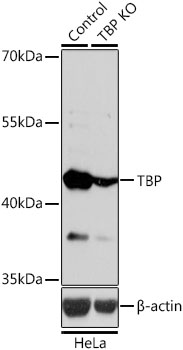 TBP antibody