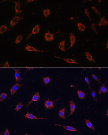 TOLLIP Antibody