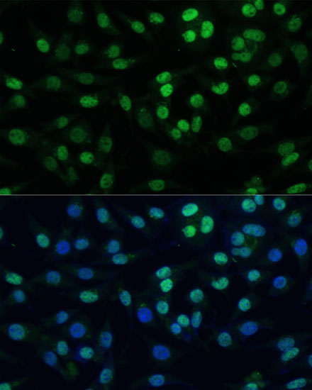 TRIM28 Rabbit Polyclonal Antibody