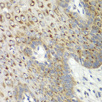 CDK1 Rabbit Polyclonal Antibody