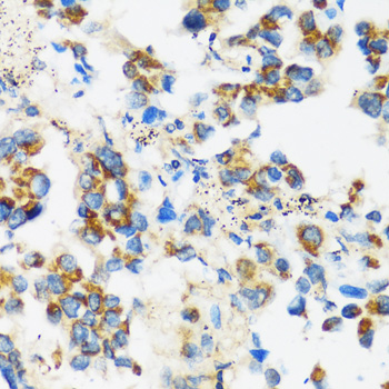 APOBEC3F Polyclonal Antibody