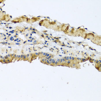ATP2C1 Rabbit Polyclonal Antibody