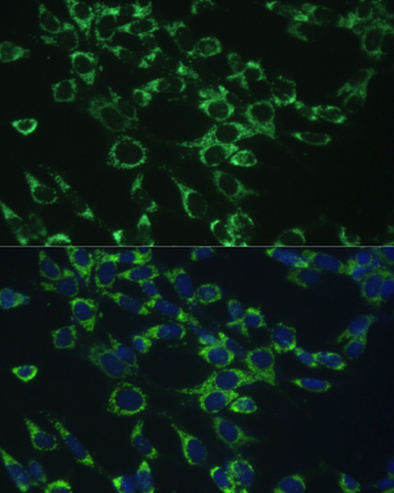 COX5B Rabbit Polyclonal Antibody