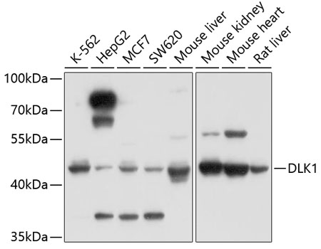 DLK1 antibody