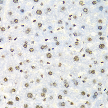 IGF2BP2 Rabbit Polyclonal Antibody