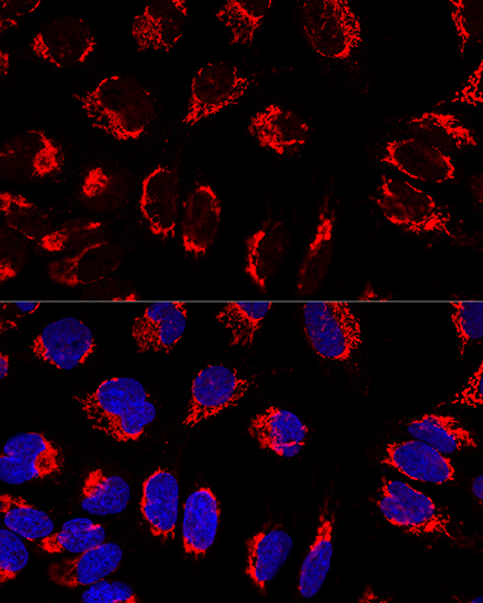 IMMT antibody