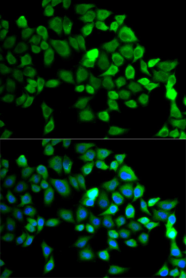 CUL2 Rabbit Polyclonal Antibody