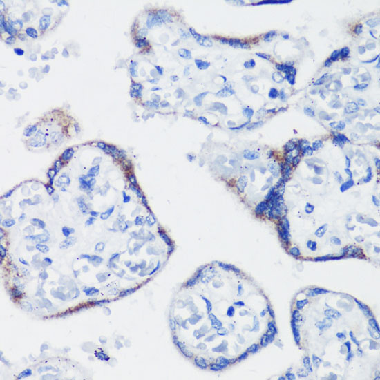 KISS1 antibody
