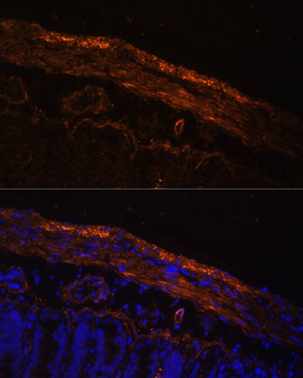 MYL9 antibody