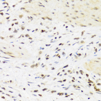 SUMO4 antibody