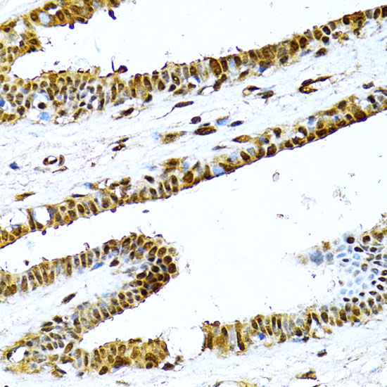 NFKB2 antibody