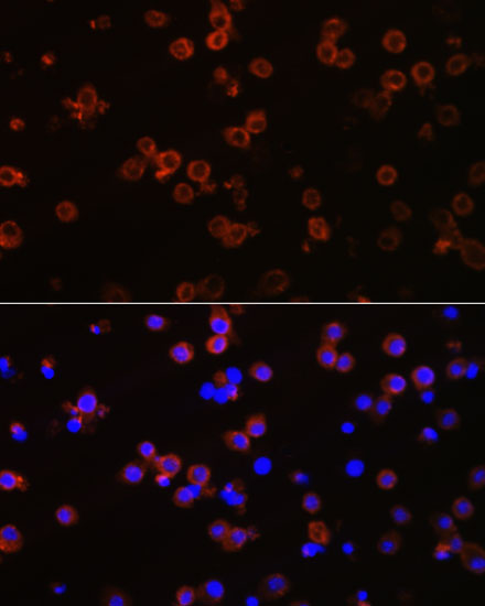 CXCR2 Rabbit Polyclonal Antibody