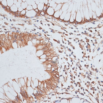 KIFC1 Rabbit Polyclonal Antibody