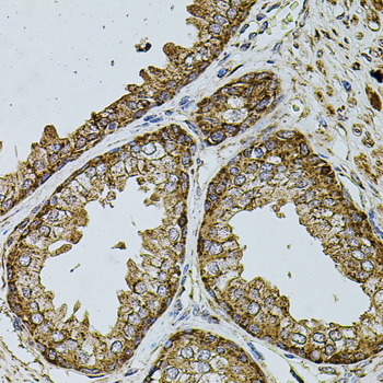 UQCRC1 Rabbit Polyclonal Antibody