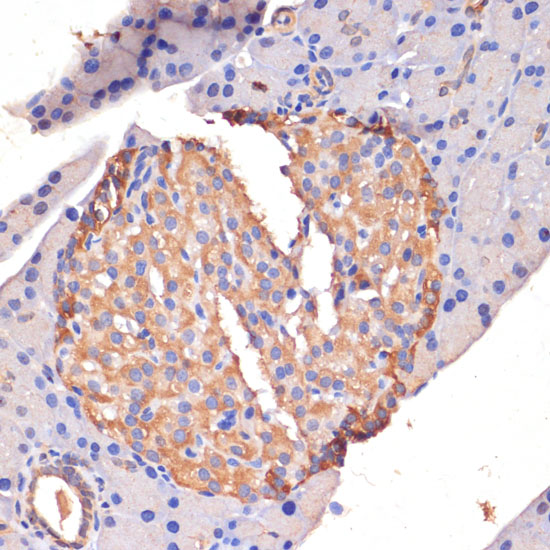 STING / TMEM173 Polyclonal Antibody