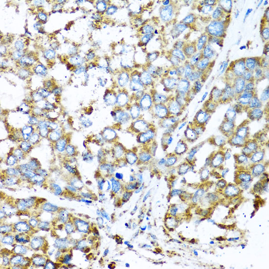 COX6A1 Polyclonal Antibody