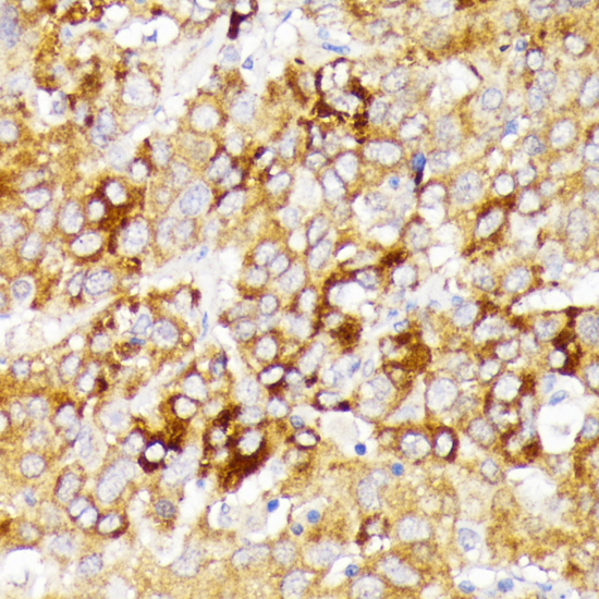GALC Rabbit Polyclonal Antibody
