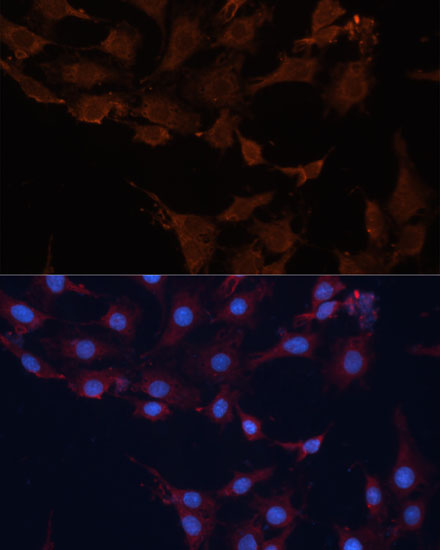 HMGCS1 Rabbit Polyclonal Antibody