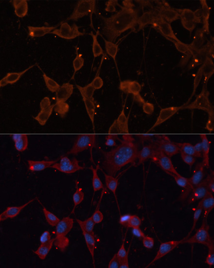 INPP5B Rabbit Polyclonal Antibody