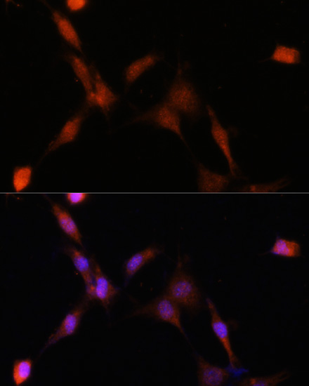 PSMA7 Rabbit Polyclonal Antibody