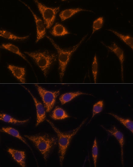 HSPA13 Polyclonal Antibody