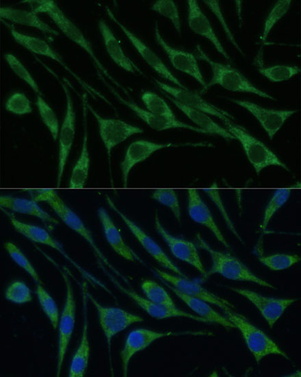 VARS Polyclonal Antibody